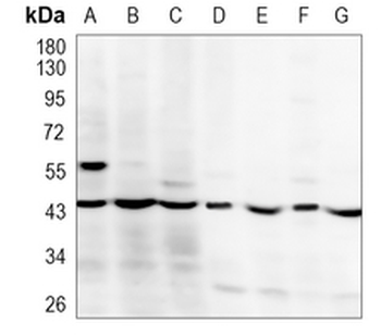 PGK1/2 Rabbit Polyclonal Antibody