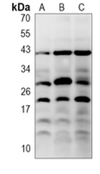 MYL2 (Phospho-S15) Rabbit Polyclonal Antibody