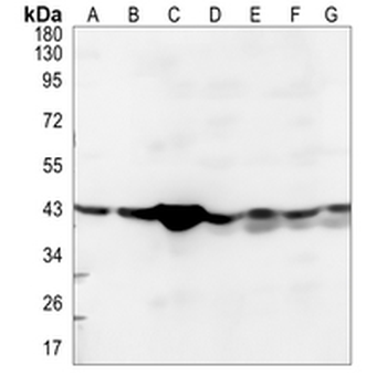 EDG4 Rabbit Polyclonal Antibody