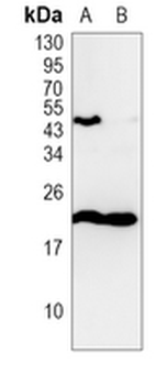 FDCSP Rabbit Polyclonal Antibody