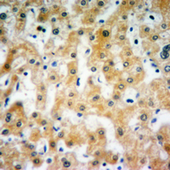 FDCSP Rabbit Polyclonal Antibody