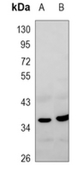 SFRP1 Rabbit Polyclonal Antibody