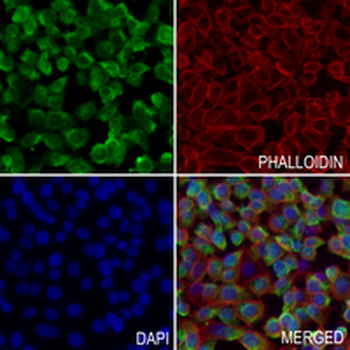 CD66e Rabbit Polyclonal Antibody