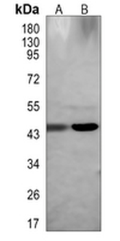 TSSK1B Rabbit Polyclonal Antibody