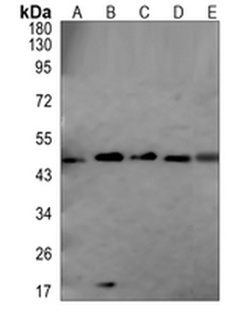 TRIB3 Rabbit Polyclonal Antibody