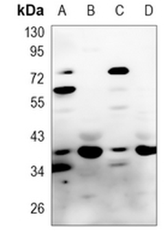 HSPA6/7 Rabbit Polyclonal Antibody
