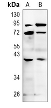 CD158f2 Rabbit Polyclonal Antibody