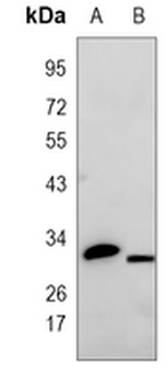 Calretinin Rabbit Polyclonal Antibody