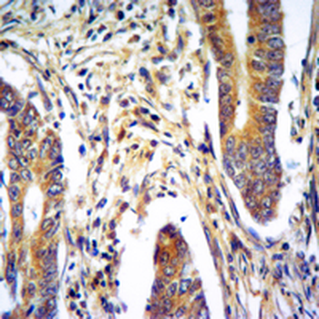 CIDEC Rabbit Polyclonal Antibody