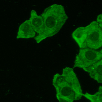 CIDEC Rabbit Polyclonal Antibody