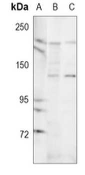 MRCK beta Rabbit Polyclonal Antibody