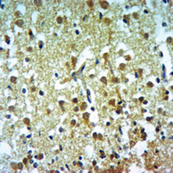 MRCK beta Rabbit Polyclonal Antibody