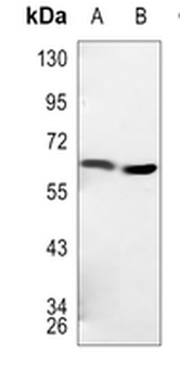 TBC1D3 Rabbit Polyclonal Antibody