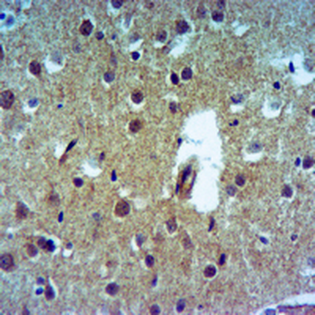 CDK2AP2 Rabbit Polyclonal Antibody