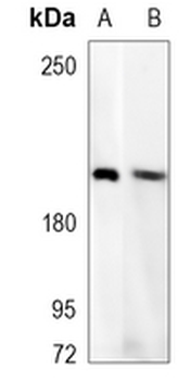 TSC2 Rabbit Polyclonal Antibody