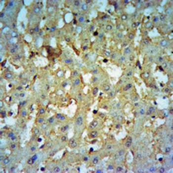 TSC2 Rabbit Polyclonal Antibody