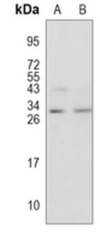 RGS19 Rabbit Polyclonal Antibody