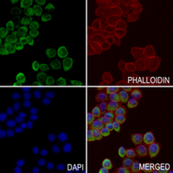 RGS19 Rabbit Polyclonal Antibody