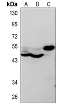 MKK5 Rabbit Polyclonal Antibody