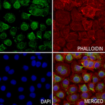 MKK5 Rabbit Polyclonal Antibody