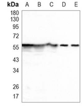 Pyruvate Kinase Rabbit Polyclonal Antibody