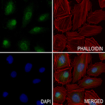 Pyruvate Kinase Rabbit Polyclonal Antibody
