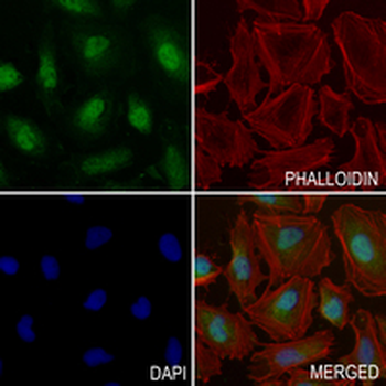 PI3K p85 alpha Rabbit Polyclonal Antibody