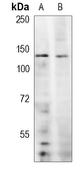 PER2 Rabbit Polyclonal Antibody