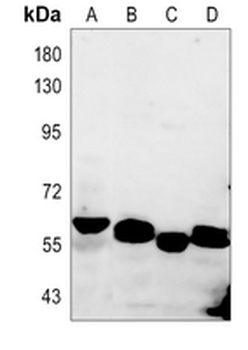 Zyxin (Phospho-S142) Rabbit Polyclonal Antibody