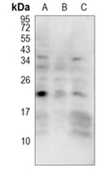 Von Hippel Lindau (Phospho-S68) Rabbit Polyclonal Antibody