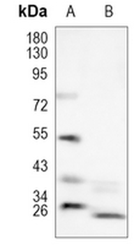 Presenilin 1 (Phospho-S353) Rabbit Polyclonal Antibody