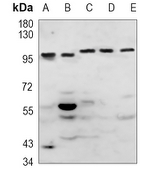 FER (Phospho-Y714) Rabbit Polyclonal Antibody
