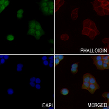 FER (Phospho-Y714) Rabbit Polyclonal Antibody