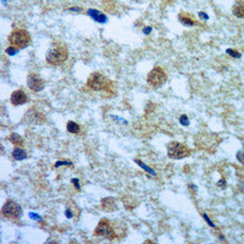 Rabphilin 3A (Phospho-S237) Rabbit Polyclonal Antibody