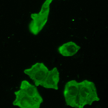 Rabphilin 3A (Phospho-S237) Rabbit Polyclonal Antibody