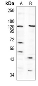 SIRT1 Rabbit Polyclonal Antibody