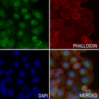 SIRT1 Rabbit Polyclonal Antibody