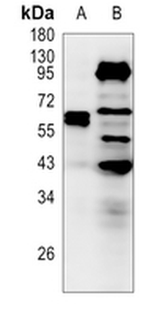 NF-kappaB p65 Rabbit Polyclonal Antibody