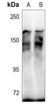 KANK1 Rabbit Polyclonal Antibody