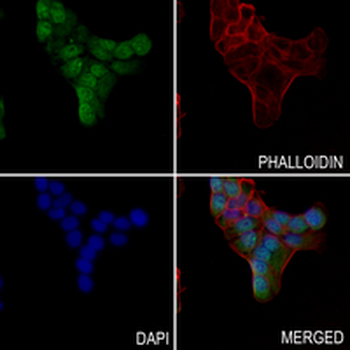 KANK1 Rabbit Polyclonal Antibody