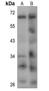 MCOLN1 Rabbit Polyclonal Antibody