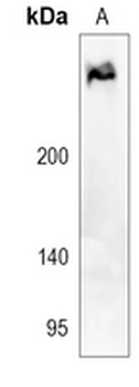 TRPM6 Rabbit Polyclonal Antibody