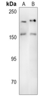 TRPM2 Rabbit Polyclonal Antibody