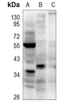 TTC35 Rabbit Polyclonal Antibody