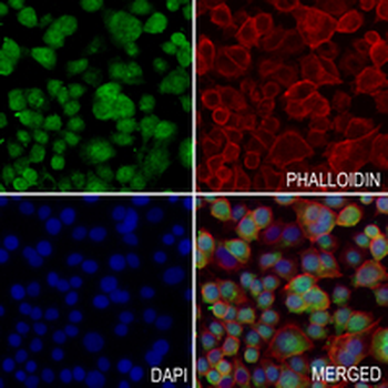 TTC35 Rabbit Polyclonal Antibody
