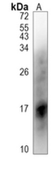 Prothymosin alpha Rabbit Polyclonal Antibody