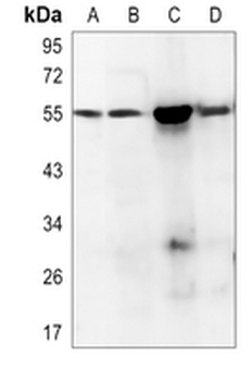 Alpha-tubulin (Acetyl-K112) Rabbit Polyclonal Antibody