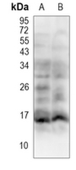 Survivin Rabbit Polyclonal Antibody