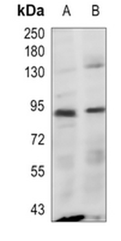 CD97 Rabbit Polyclonal Antibody