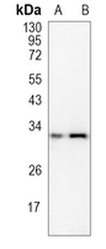 CD32b/c Rabbit Polyclonal Antibody